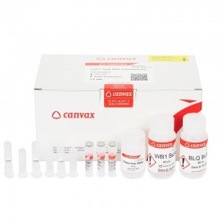 CVX™ Viral RNA Extraction Kit, CE-IVD